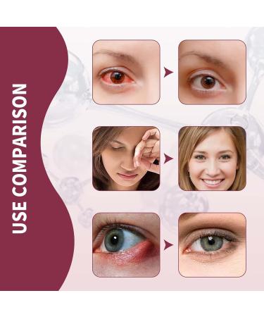 Stye Eye Treatment Serum - Fast Relief for Styes, Chalazion & Blepharitis (3pcs) - Buy Online on GoSupps.com