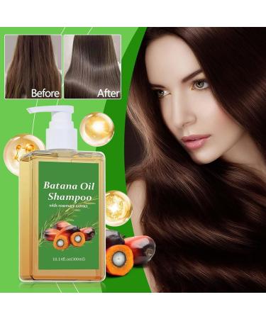 Lot de 2 shampoings l'huile Batana 2025 - 300 ml - Shampooing anti-chute - quilibre la teneur en graisse limine les pellicules agit contre les d mangeaisons - Hydrate - Lisse les cheveux - Buy Online on GoSupps.com