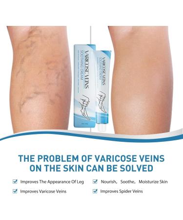 Raura Varicose Veins Cream Varicose Veins Cream Improves blood circulation - Buy Online on GoSupps.com