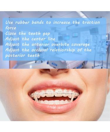 Buy 300PCs Dental Orthodontic Latex Elastics | Elastic Braces Gum & Toothed Gum Pull Tapes | High-Quality Rubber Bands for Orthodontics - Buy Online on GoSupps.com