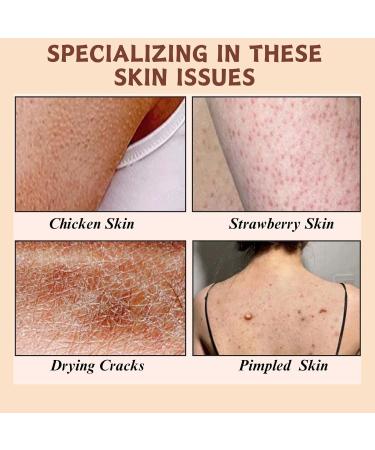 Trendyfave Mango Body Butter Large-capacity Body Lotion Body Moisturiser With Mango Body Lotion for Dry Skin Body Skin Care Smooth Skin Deeply Moisturize Skin Body Butter For Women & Men 200ml - Buy Online on GoSupps.com