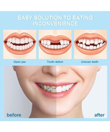 Frenzify Artificial Teeth Set - DIY Comfortable Upper & Lower Dentures for Adults - White Plug-In False Teeth - Buy Online on GoSupps.com