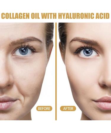 Body Shaping Essential Oil for Women Collagen Lifting Body Oil Fat and Calorie Blocking Serum Skin Tightening Firming Serum Oil - Buy Online on GoSupps.com