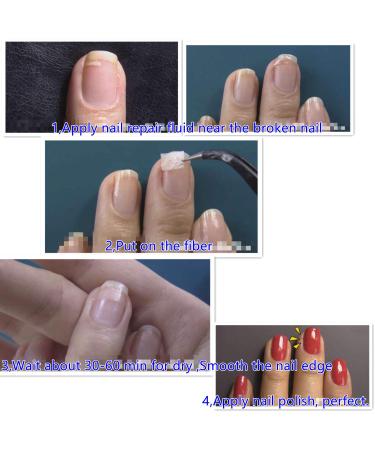 5ml Instant Cracked Nail Repair Gel - Nail Strengthener & Phototherapy Glue - Restore Weak, Broken, & Damaged Nails - Fast Fix for Nail Cracks - 1pc - Buy Online on GoSupps.com