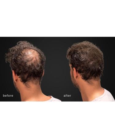 MAXX PRO Series Volumizing Hair Fibers with Real Keratin | Hypoallergenic & Dermatologist Tested | 60 Days Supply for Hair Loss (Gray) - Buy Online on GoSupps.com