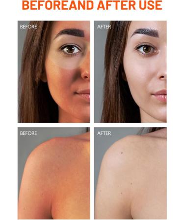 Sunscreen SPF 50 Face - Hyaluronic Acid Sunscreen SPF50+ PA++++ Daily Moisturizing Sunscreen With No White Cast - Buy Online on GoSupps.com