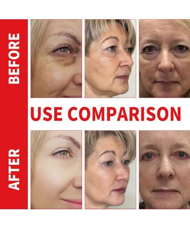 Niacinamide Serum Facial Serum Against Pigment Spots Anti-Aging Dark Spots Anti Wrinkle Serum Facial Serum Moisturizing Firming Anti Wrinkle Effect Essence - Buy Online on GoSupps.com