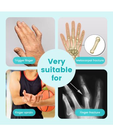 Adjustable Finger Rail Support | Orthosis for Finger Fractures & Arthritis - International Shipping - Buy Online on GoSupps.com