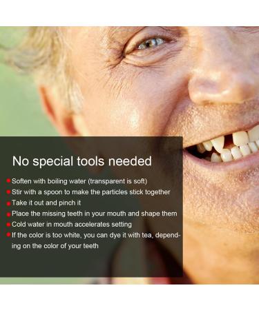 Ververt Touch Temporary Tooth Repair - 100g Filling Material for Broken & Missing Teeth - Fast International Shipping - Buy Online on GoSupps.com