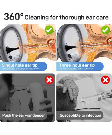Electric Ear Wax Removal Kit Ear Irrigation Flushing System with Dual Large Water Tank 4 Pressure Mode 2 Tips Safe Water Ear Cleaner Effective Ear Flushing Kit for Adults Waterproof IPX6 Black - Buy Online on GoSupps.com