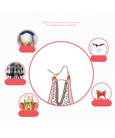 60 ml Dental Plaque Detection Indicator | Oral Tartar Test for Kids & Adults | Improve Tooth Hygiene - Buy Online on GoSupps.com