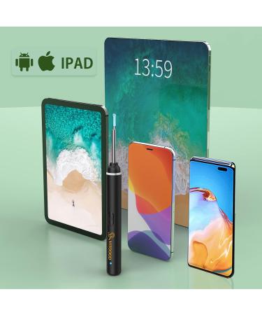 VITCOCO Ear Wax Removal Kit - 1920P HD Otoscope for iPhone & Android - 6 LED Lights - Visual Ear Scope for Ear Cleaning - Ear Camera Tool - Buy Online on GoSupps.com