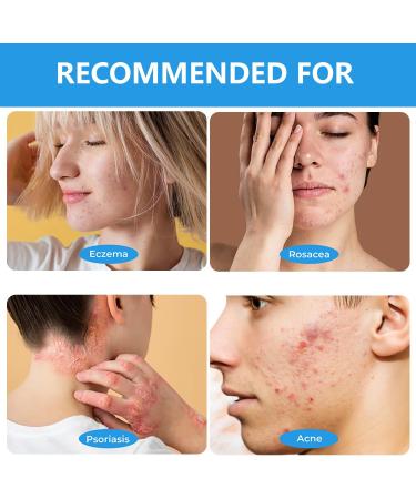  MagiSel Psoriasis Anti Itch Cream 20g - Buy Online on GoSupps.com