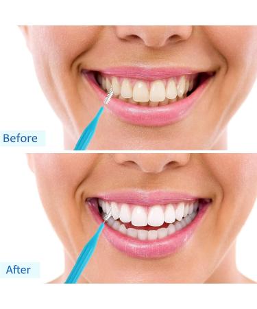 50pc Interdental Braces Brush Set for Oral Hygiene - Blue, Green, Purple Colors - Buy Online on GoSupps.com