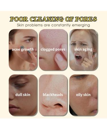 Peel Off Face Masks Retinol Gold Foil Peel Off Mask Anti Wrinkle Anti Aging Face Mask Skincare Gold Facial Mask Blackhead Remover Moisturizing Gold Mask Fade Fine Lines Brightening - Buy Online on GoSupps.com