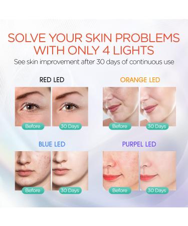 Buy Eono LED Face Mask | Cordless Rechargeable Light Therapy for Anti-Aging & Acne Control - 4 Color Skin Treatment - Buy Online on GoSupps.com