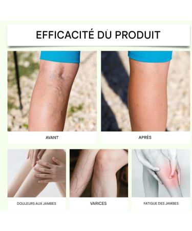 Roll-On Apaisant pour Articulations | Baume Apaisant Roll-On Confort Genoux - Applicateur R cup ration Musculaire Genou Dos Nuissance paules Sportifs Adultes Amateurs Fitness - Buy Online on GoSupps.com