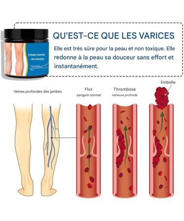  gifyym Leg Cream | Natural Calf Cream 50g | Natural Nourishing Lotion for Pregnant Women Men Sports Events Family Travel Outdoor Hikers - Buy Online on GoSupps.com