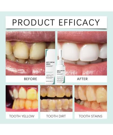 Dental Care Liquid Removal of Bad Debris 20ml - Liquid Oral Cleanser for Teeth | for Home Travel Camping Adults Women Men - Buy Online on GoSupps.com