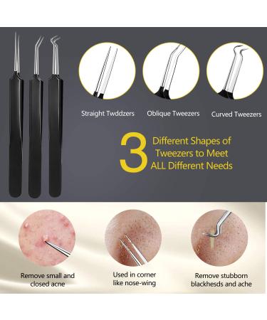 13 Pcs BAbuGIG Pimple Popper Tool Kit for Acne and Blackhead Removal - Comedone Extractor Set for Quick Pimple Extraction and Blemish Removal - Buy Online on GoSupps.com