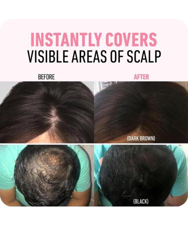  gifyym Hair Powder - Instant Hair Color - Grey Bristle Concealer | Root Reverse & Gray Concealer with Applicator | Long-Lasting Hair Shade Powder for Thinning The - Buy Online on GoSupps.com