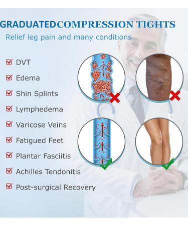 MGANG Medical Compression Pantyhose for Men & Women - 15-20mmHg Support Tights Open Toe Opaque Stockings for Edema & Varicose Veins - Beige Small Size - Buy Online on GoSupps.com
