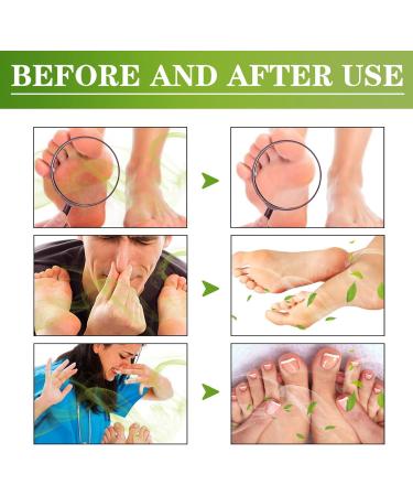 Sweaty Feet Foot Spray Foot Spray Anti sweat spray Foot Spray Odor Eliminators Spray Effectively Eliminate Foot Odor Anti Foot Odor Fast Deodorization - Keep Freshes & Dry for a Long Time 30ml - Buy Online on GoSupps.com