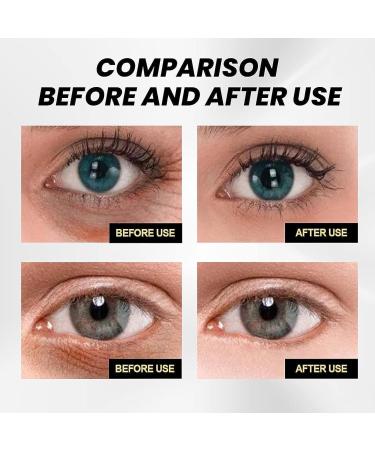 Celyn Instant Firm Eye Lift Pocket Cream - Anti-Aging Eye Cream for All Skin Types (2PCs) - Shop Internationally! - Buy Online on GoSupps.com