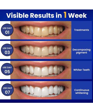 Teeth Whitening Strips Professional Teeth Whitening Strips 14 Packs 28 Pcs at Home Teeth Whitener Safe for Enamel Suit for Sensitive Teeth Tooth Whitening Kits - Buy Online on GoSupps.com