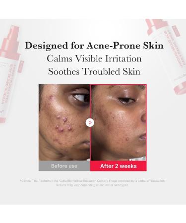 medicube Power Soothing Spray | Hypochlorous Acid Spray For All Skin Types Delicate Skin | Daily Skin Solution & Post-Sun Care | HOCI Facial Mist for Soothing & Calming | Korean Skincare | 1.69 fl.oz 50 ml - Buy Online on GoSupps.com