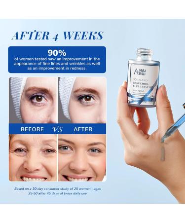 ANAiRUi Bakuchiol Oil - Natural Retinol Alternative Plant Derived - Face Oil with Blue Tansy Squalane Jojoba - Reduces Fine Lines & Wrinkles Soothes and Hydrates Skin 30 ml - Buy Online on GoSupps.com