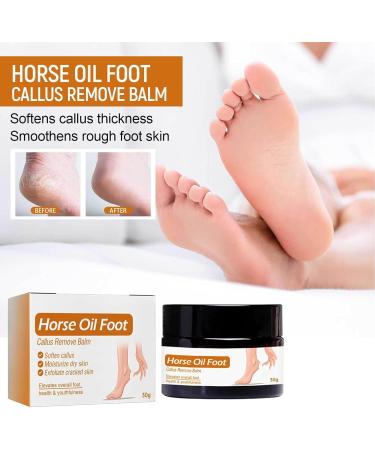 Horse Oil Foot Repair Cream 3Pcs 30g Foot Care Cream Easily Absorbed Moisturizing Horse Oil Foot Care Cream for Extremely Dry Cracked Feet - Buy Online on GoSupps.com