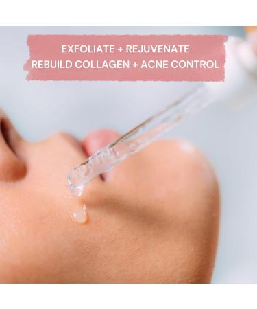 Turbinne Synergy Extra Strength Chemical Peel | 5% Salicylic Acid & AHA | Exfoliate & Rebuild Collagen | Acne Control (3 Pack - Buy Online on GoSupps.com