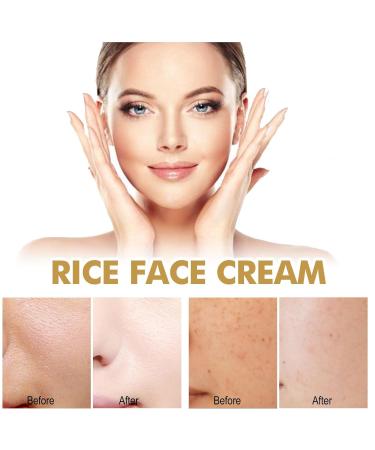 G neric Crema para Aclarar las Axilas y Partes Intimas Collagen Cream for Women Crema Para Manchas Oscuras En La Cara Para Piel Entrepierna Manchas Codos Piernas Zonas Rodillas Cuello 1pcs - Buy Online on GoSupps.com