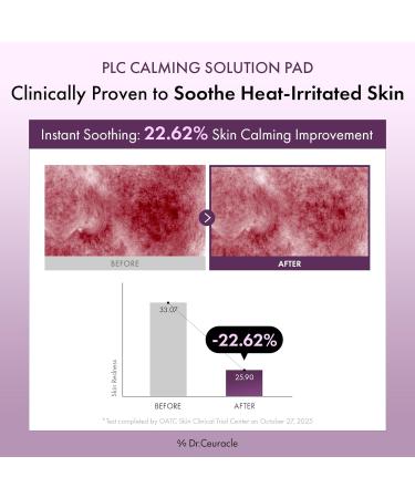 Dr.Ceuracle PLC Calming Solution Pad - Instant Calming and Soothing Toner Pad for Sensitive Skin Korean Post Laser Skincare (130 Pads) - Buy Online on GoSupps.com