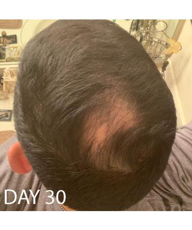 Biotin Hair Growth Conditioner - High Potency Anti Hair Loss Treatment with Vitamins E, A, and C - 8.5 Ounce - Buy Online on GoSupps.com