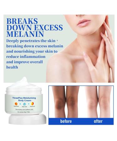 BEROZA Cremas Para Las Manchas de La Corporales 50G Para Piel Entrepierna Manchas Codos Piernas Zonas ntimas Cara Axilas Rodillas Cuello 50G - Buy Online on GoSupps.com