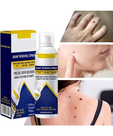  Dgayaeic Facial Bump Renewal Spray Recover Warts 60 ml Chill Erase Bump Renewal Spray soothing and refreshing formula reduces imperfections - Buy Online on GoSupps.com