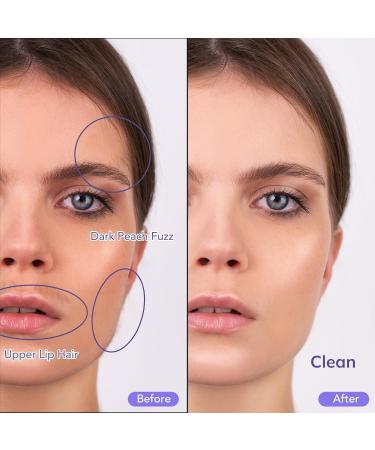 PELCAS Electric Dermaplaning Tool with LED Light - Mini Facial Razor 3 Speeds for Peach Fuzz & Exfoliation - At Home Hair Removal System for Women - 6 Blades BV18-712 Purple - Buy Online on GoSupps.com