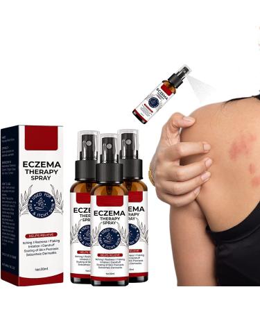 GFOUK Natural Eczema Therapy Spray All Natural Eczema Treatment Psoriasis Treatment Vitiligo Skin Repair Spray Skin Care Pain & Itch Spray Fast Acting Itch Relief (3 Pcs)