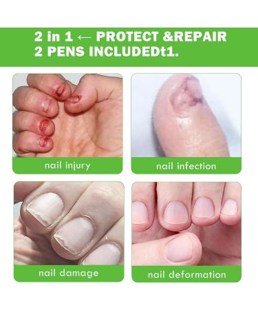 Nail Bite Repellent - Anti-Bite 15ml Protective Strengthening Formula Hard Coat Secure Finger Guard Helps Prevent Nail Bites | Nail Protection Treatment for a P - Buy Online on GoSupps.com