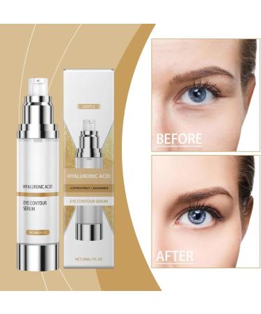 Eye Contour Serum with Hyaluronic Acid Anti-Wrinkle Eye Contour Caffeine and Niacinamide 15ml - Eye Contour Cream for Women - Anti-Dark Circles and Wrinkles Eye Cream (2pc) - Buy Online on GoSupps.com