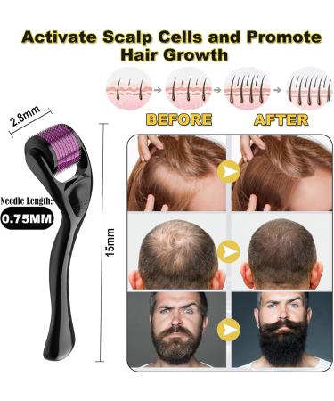 JIEYUCHU Derma Roller 0.75 mm Dermaroller Hair 660 Titanium Micro Needle Roller for Face Skin Care Stimulate Hair Regrowth - Buy Online on GoSupps.com