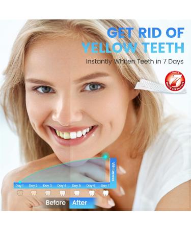 Teeth Whitening Kit: 5D White Strips for Smoking Coffee Stains | 14 Sets, 28pcs | Home Tooth Whitening with Mint Flavored Strips - Buy Online on GoSupps.com