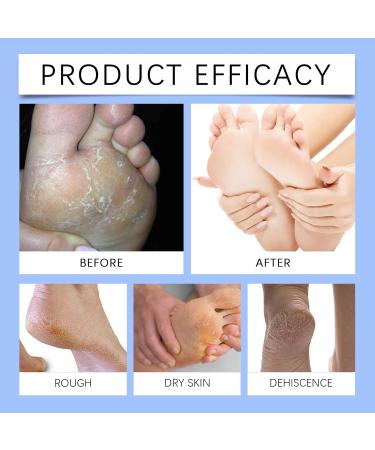  CongRong Foot cream with 60% urea for cracked heels and dry skin coconut oil to moisturize deep hydration fast absorption moisturizes dry skin - Buy Online on GoSupps.com