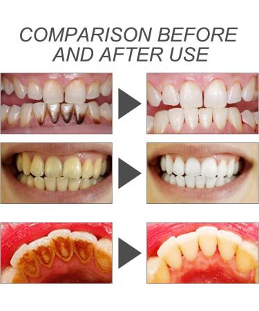 Poudre Blanchissante Naturelle pour les Dents 30G 1PC Efficace pour Renforcer les Dents et les Gencives Enlever les Taches - Buy Online on GoSupps.com