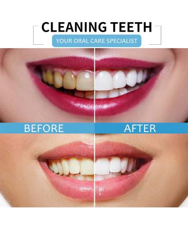 Natural Fruit Teeth Whitening Toothpaste - Deep Cleaning & Stain Removal (60g) - Baking Toothpaste - International Shipping Available - Buy Online on GoSupps.com