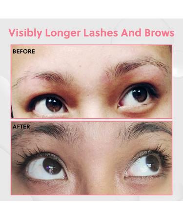 ForChics ForLash & ForBrow Growth Serum Bundle - Fuller Eyelashes & Eyebrows | Organic & Vegan Formula - 0.10 fl. oz/3ml - Buy Online on GoSupps.com