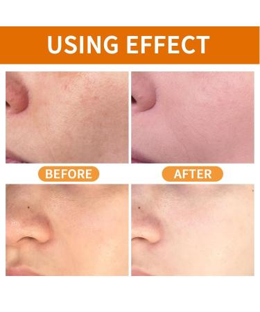 Orange Exfoliating Gel & Orange Enzymes Gel - Purifying Facial Scrub for Face/Body Deep Clean Pores & Moisturize Non-Abrasive Exfoliator for All Skin Types (2pc 2.12oz) 2pc 2 Fl Oz (Pack of 1) - Buy Online on GoSupps.com