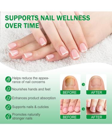 7 Days - S rum naturel pour ongles au gingembre huile de jojoba et de tournesol - Restaure les ongles endommag s soin anti-fongique pour ongles des pieds et des doigts - 60 ml - Buy Online on GoSupps.com
